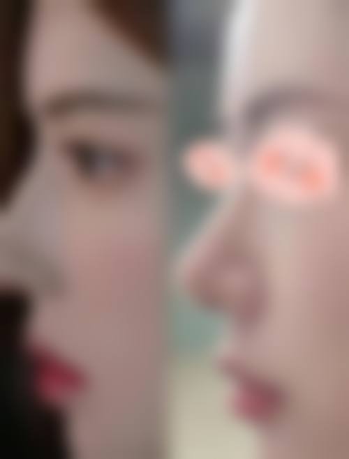 刘松医生实例