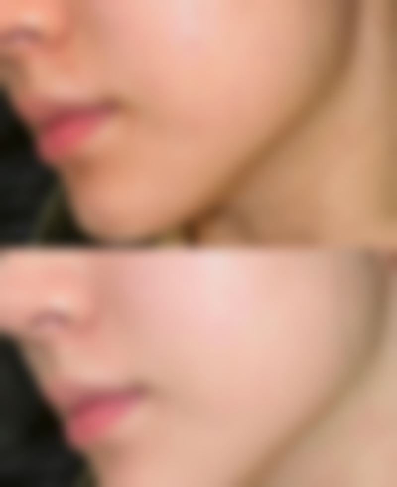 许娟医生实例