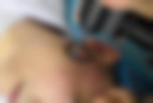 预防与护理，保护术后形态安心