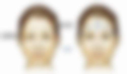 六、宁波珈禾整形专科医院怎么预约：