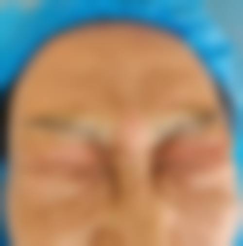 丁月医生在哪家医院怎么预约？