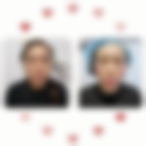 七、丽婷整形外科价格表:(仅供参考)