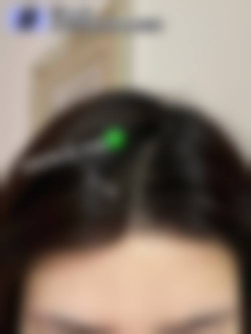 五、淮安新生植发医院实例