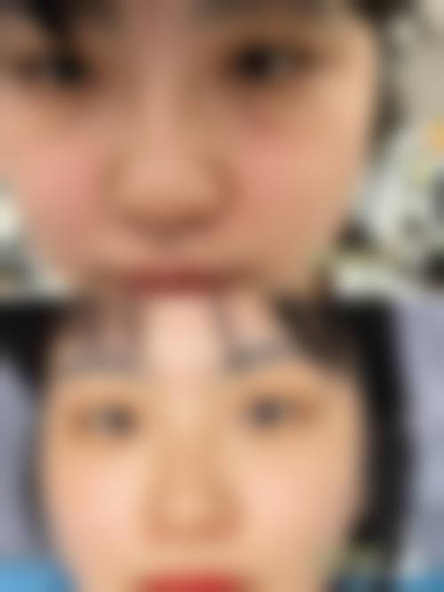 三、晋中非常好人民医院整形科医生介绍: