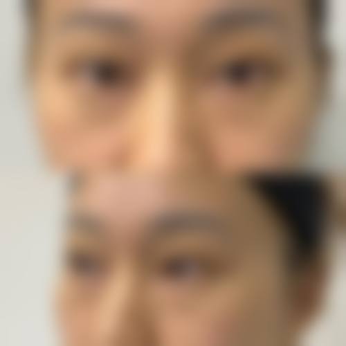 七、哈尔滨医 科 大学附属第三医院经纬医院整形美容科价格表:(仅供参考)