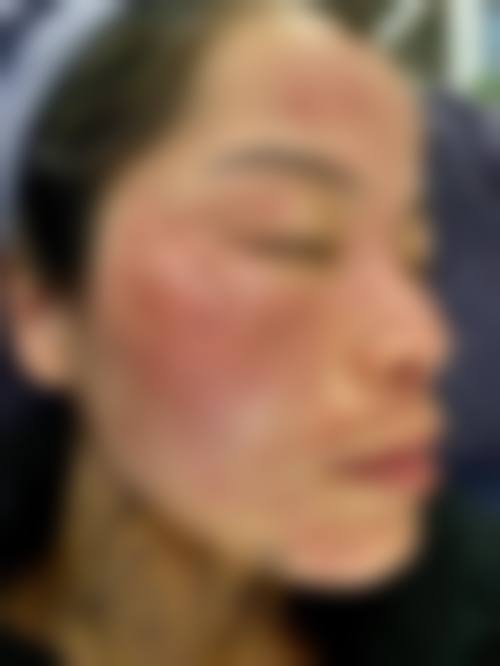 李新欣医生实例