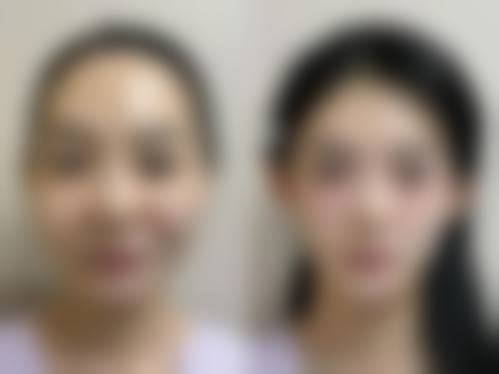 李新欣医生口碑和评价