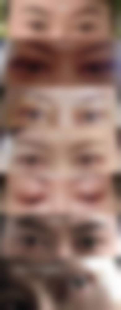 五、烟台美神整形美容医院实例