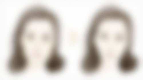 隆鼻假体的适应性:贴合人体需求