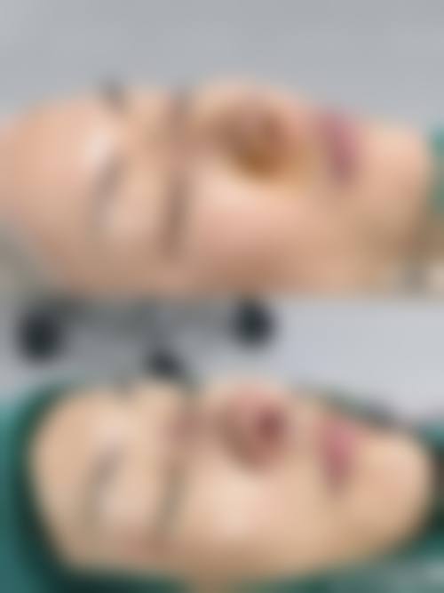 七、山东佰瑞德泰安医疗美容诊所真实的顾客评价如下: