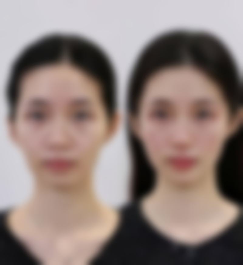 揭秘营养涂抹消除眼袋法