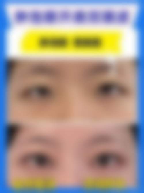 项利姣医生怎么样可靠吗？