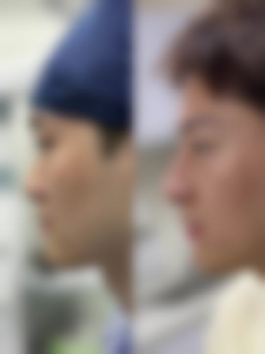 八、西宁艾薇整形医院真实的顾客评价如下：