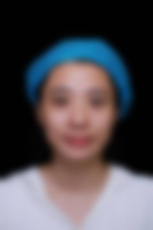 五、沈阳蒂美整形实例