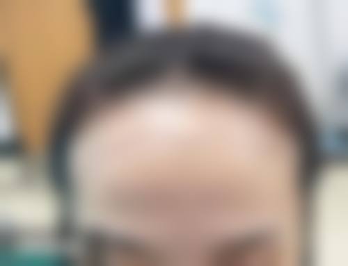 八、浙江杭州新生植发真实的顾客评价如下: