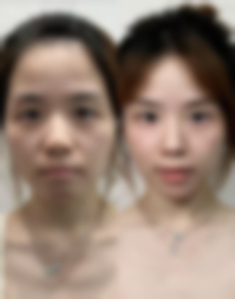 朱晓峰医生怎么样可靠吗？