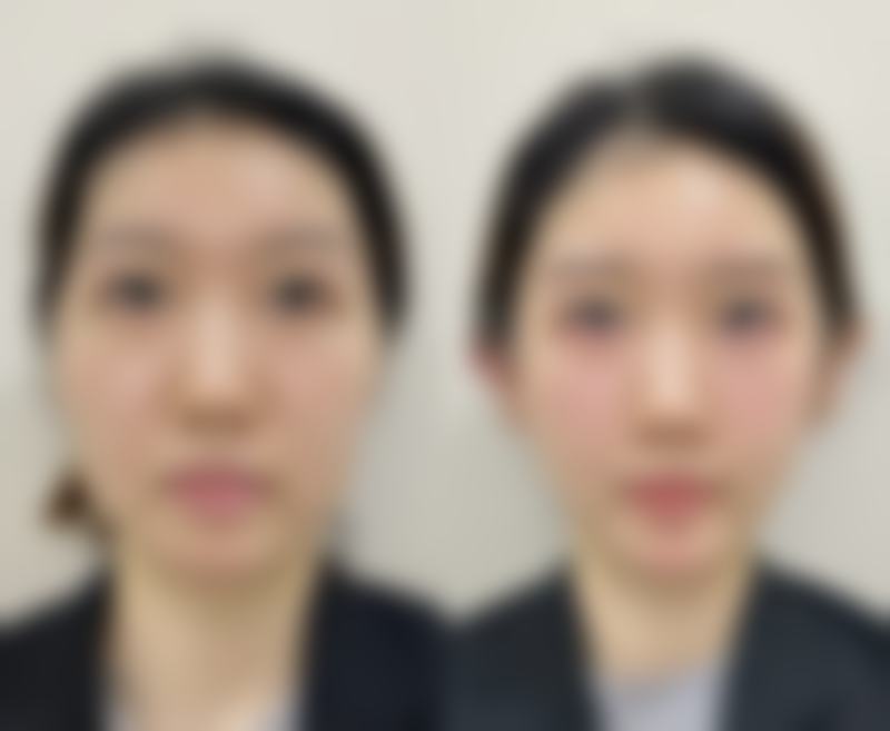 五、长沙伊美整形门诊部实例