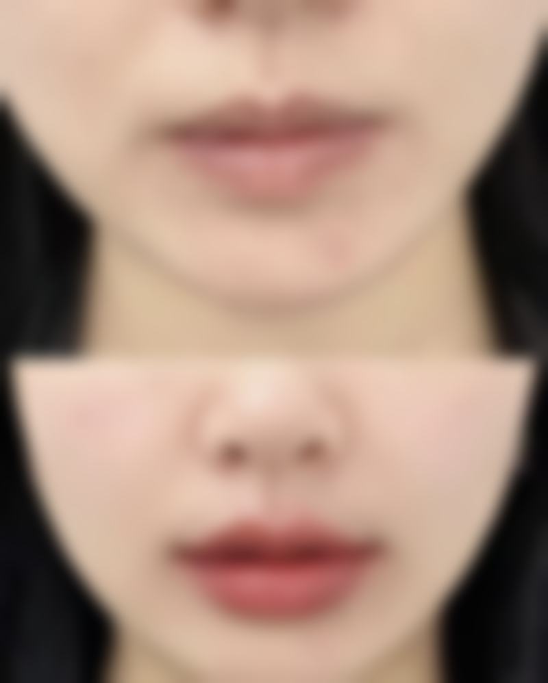 还在愁眼袋发黑?局部护理有妙招