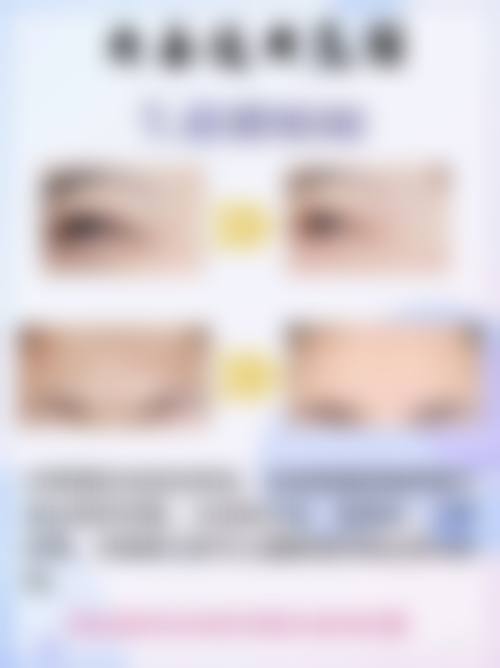 虞美人裸妆仙子隆鼻：不同隆鼻方式中的独特亮点