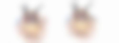 眼袋贴真能去除眼袋吗？揭秘对暂时性、轻度眼袋的改善作用与使用窍门 