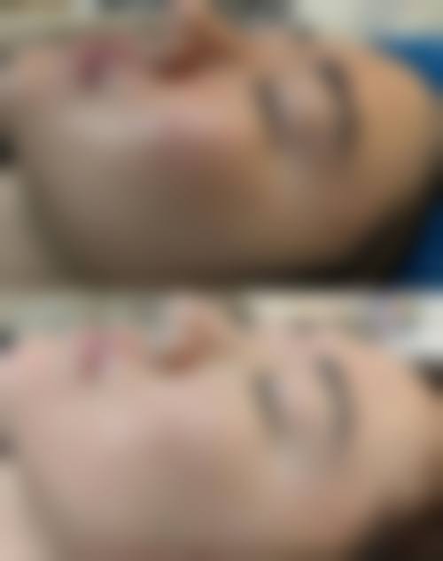 郭进医生怎么样可靠吗?