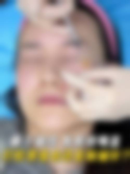 四、深圳广美医疗美容医院开展的主要项目和特色项目: