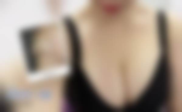 北京禾美嘉医疗美容门诊部关几梦吸脂塑形技术有多棒？