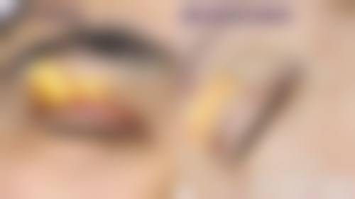 郝健医生实例