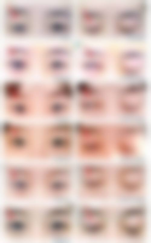 五、厦门崔美花尤加整形医院实例