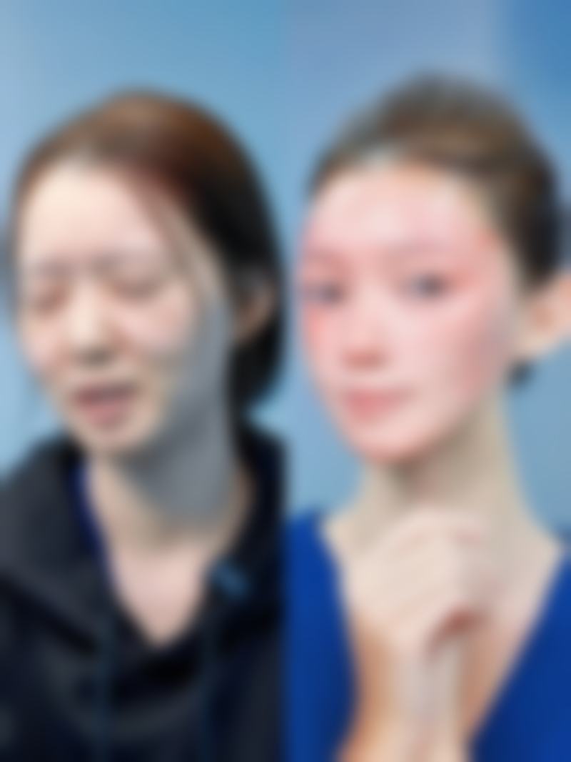 打瘦脸针有啥优势？