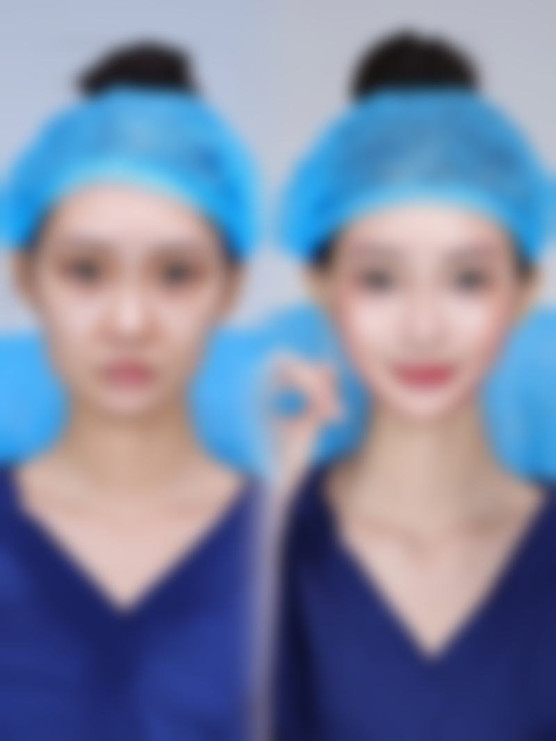 六、深圳奥拉克医疗美容医院怎么预约: