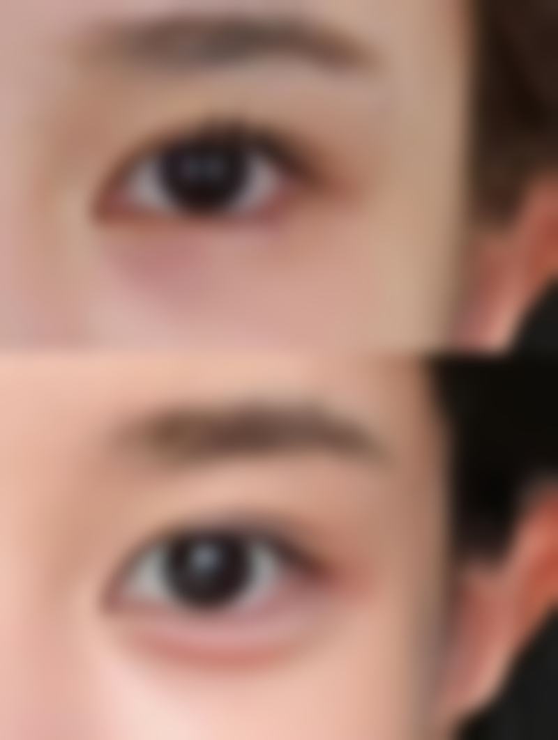 甘油真能去除眼袋吗？揭秘甘油在保湿补水及辅助改善眼部细纹上的作用 