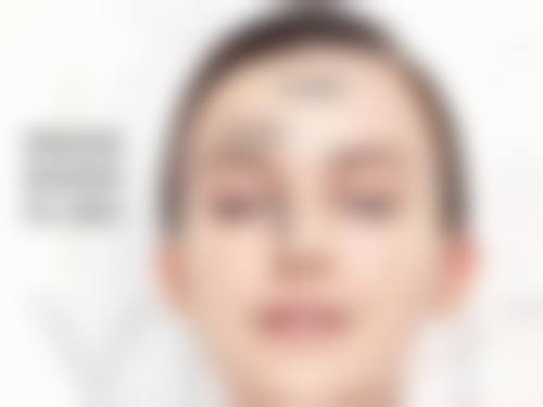 瘦脸针100U的剂量调整:因人而异更精细