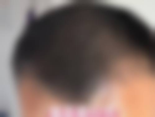 六、韩国瑞草洞健康整形外科怎么预约: