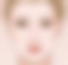 39岁有眼袋不忧!及时就医选方案