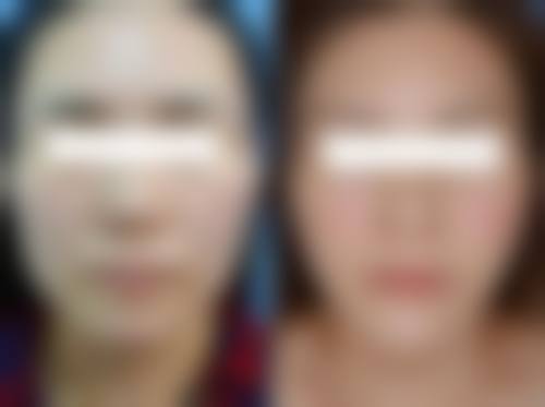 六、昆山魅莱医疗美容门诊部怎么预约: