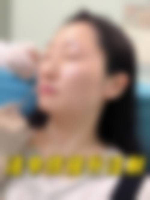IM MYUNG JIN医生怎么样可靠吗?