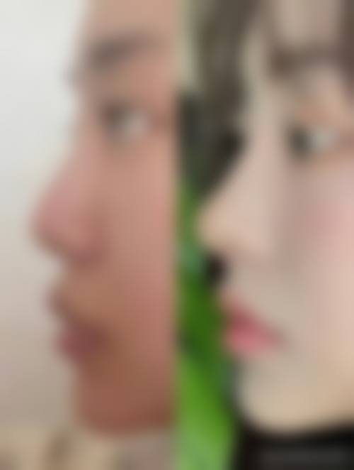 四、韩国Ieul整形外科基本信息: