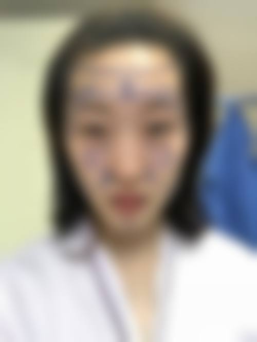 七、天津市第四 医院烧伤整形美容门诊部价格表:(仅供参考)