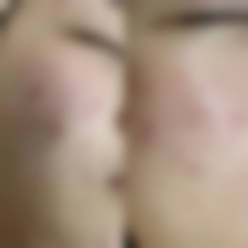 三、重庆市潼南区人民医院皮肤科医生介绍: