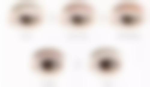 做个双眼皮究竟要多久?影响手术时长的因素揭秘