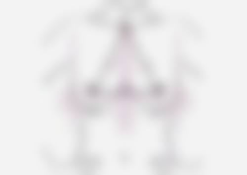 假体隆胸：光面与毛面稳定性大剖析