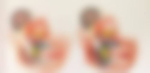 隆鼻修复期怎么缩短?术后护理有妙招