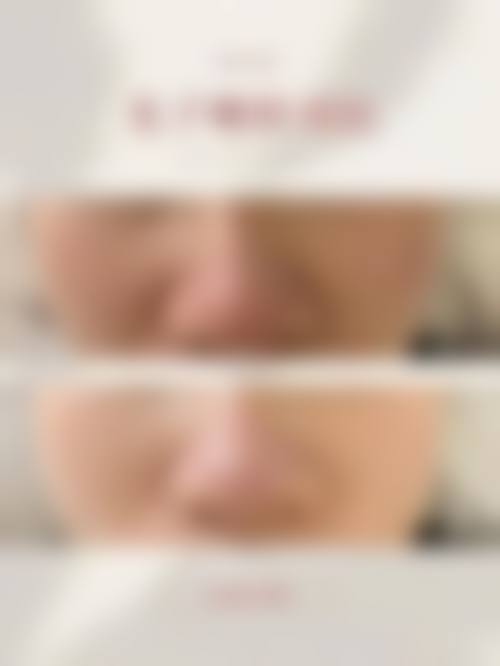 七、扬州莱沐医疗美容诊所价格表:(仅供参考)