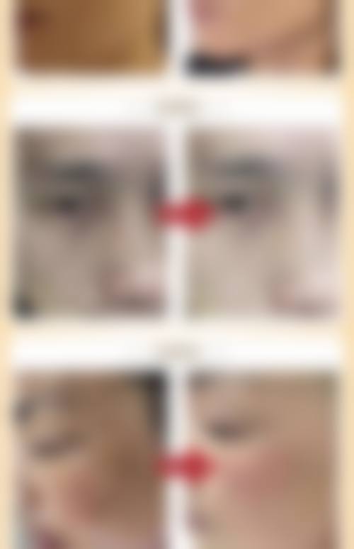七、日本Takami美容皮肤医院价格表:(仅供参考)