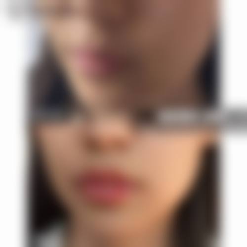 二、杭州芯美昕医疗美容门诊部正规吗?来看看医院资质: