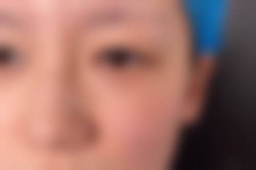 八、allery皮肤科真实的顾客评价如下: