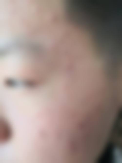 五、allery皮肤科实例
