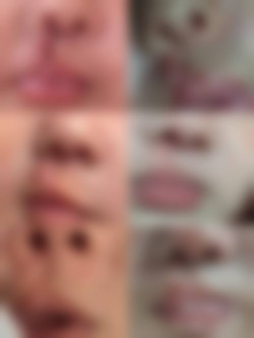 七、揭阳东南医院整形美容中 心真实的顾客评价如下: