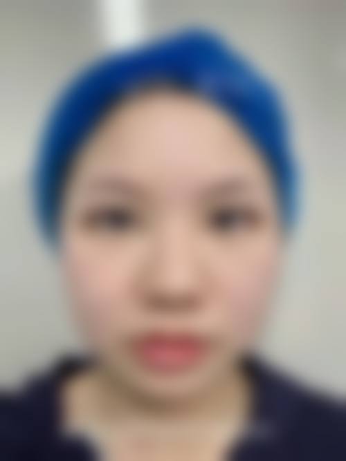 二、昆明婕熹卡整形医疗美容门诊部正规吗?来看看医院资质: